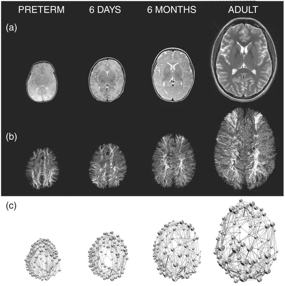 Figure 32 Maturation of the baby connectome examples of brain networks at - фото 3