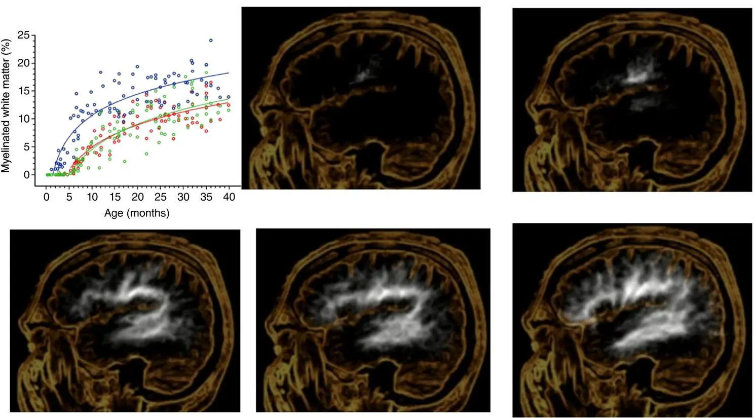 Figure 34 White matter maturation from birth through 36 months of age - фото 5