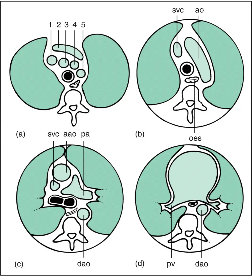 Figure 411 Principal mediastinal structures on computed tomography The - фото 56