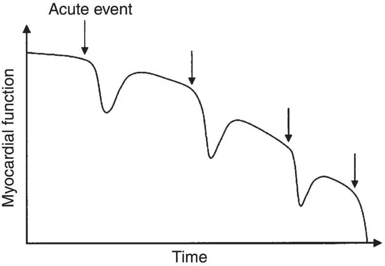 Figure 33 Recurrent acute events contribute to heart failure progression With - фото 10