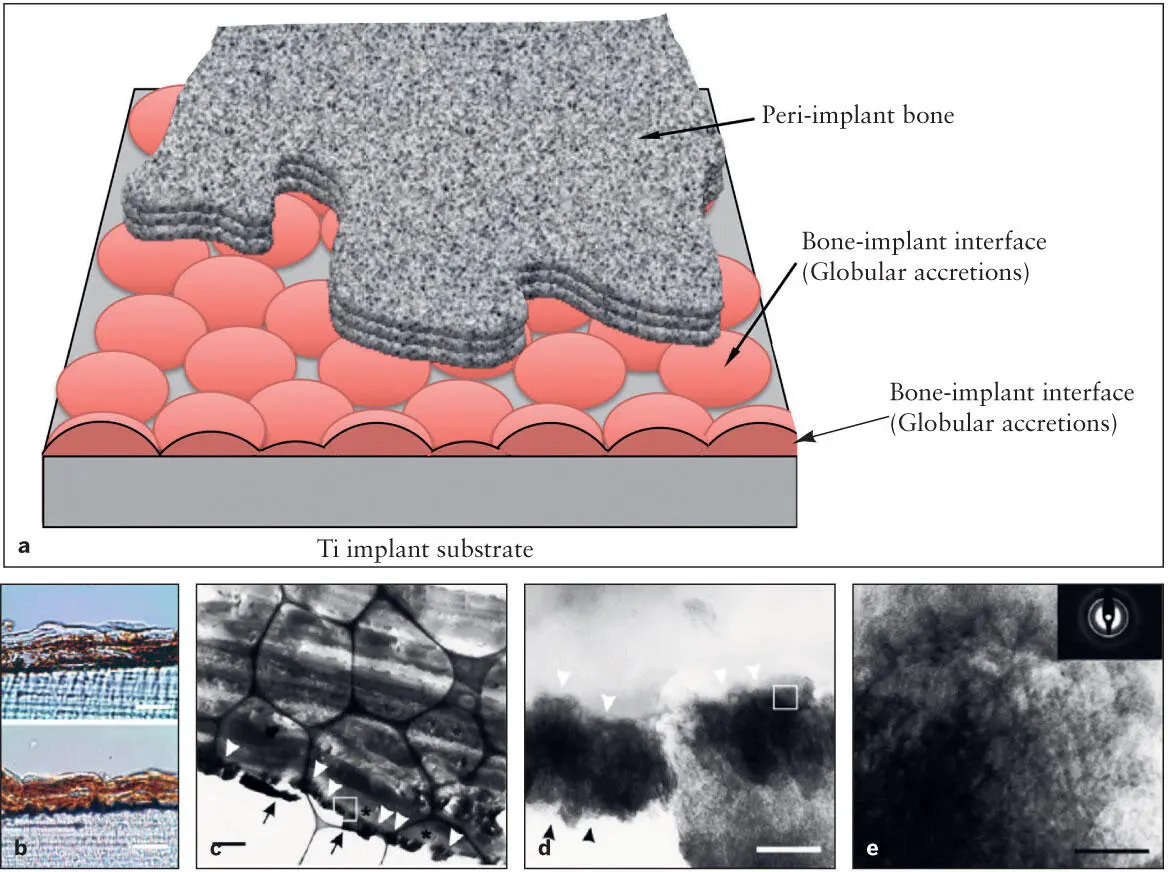 Fig 27 a Diagram of the implantbone interface There is a thin layer of - фото 33