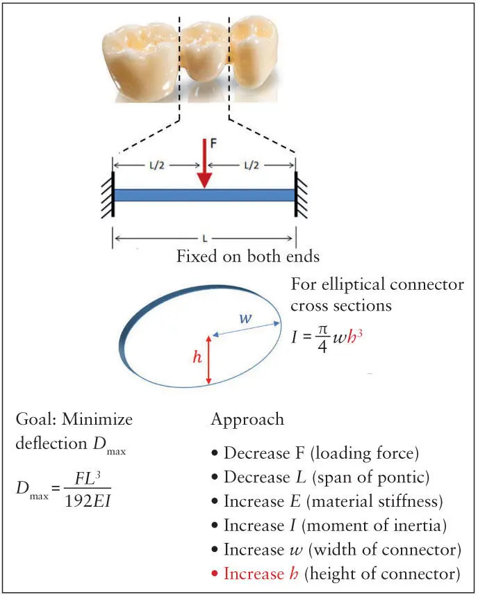 Fig 33 Prosthesis design parameters that control bending deformation D max - фото 44