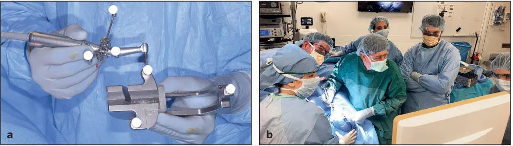 Fig 520 a Triple reflective marker spheres are anchored to the handpiece - фото 104