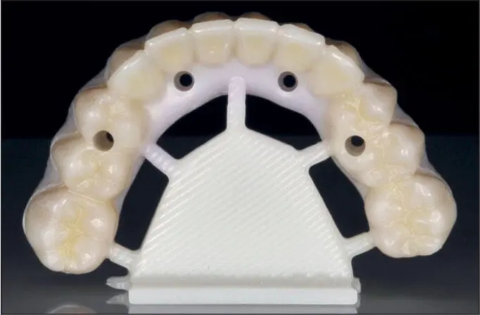Fig 56 Fully sintered monolithic zirconia prosthesis History and Technologic - фото 89