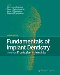 John III Beumer - Fundamentals of Implant Dentistry