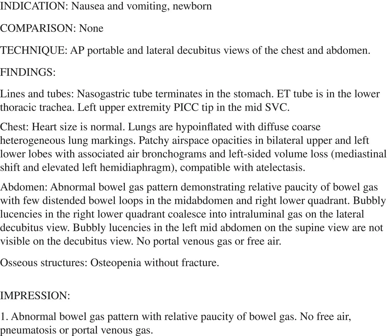 FIGURE 13 Radiological interpretation of abdominal xray of concern for - фото 5