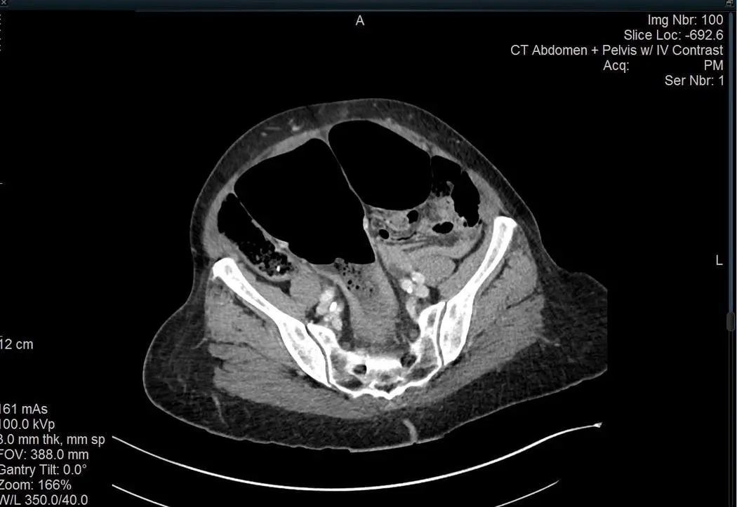 FIGURE 118 Computed tomography of the abdomenpelvis with intravenous contrast - фото 20