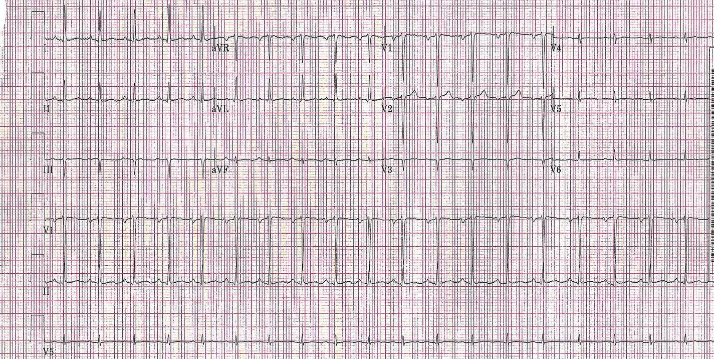 FIGURE 120 Electrocardiogram showing sinus tachycardia FIGURE 121 Flow - фото 22