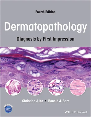 Christine J. Ko Dermatopathology обложка книги