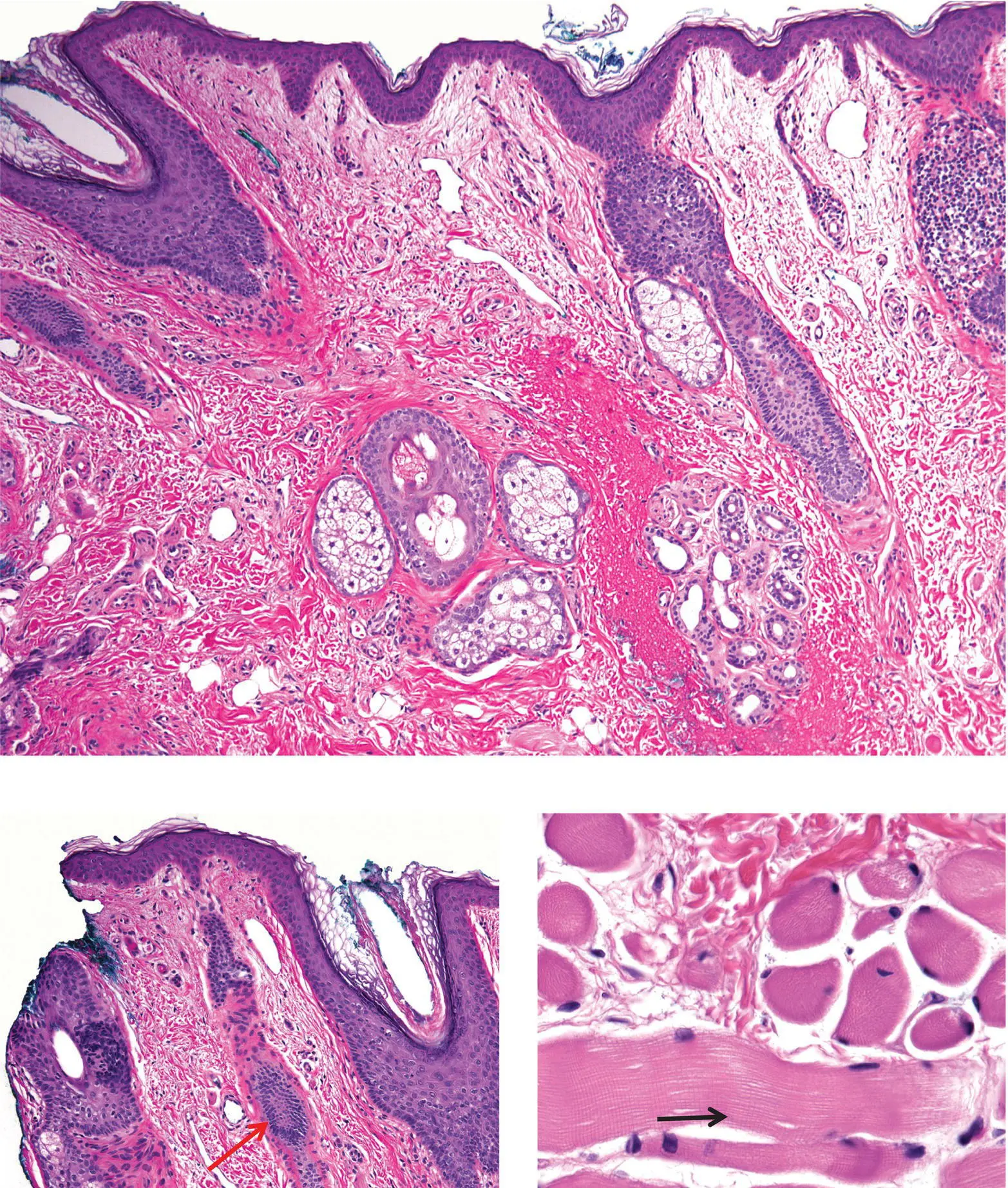 Figure 4CEyelid skin has a thin epidermis with dermal vellus hairs red - фото 17