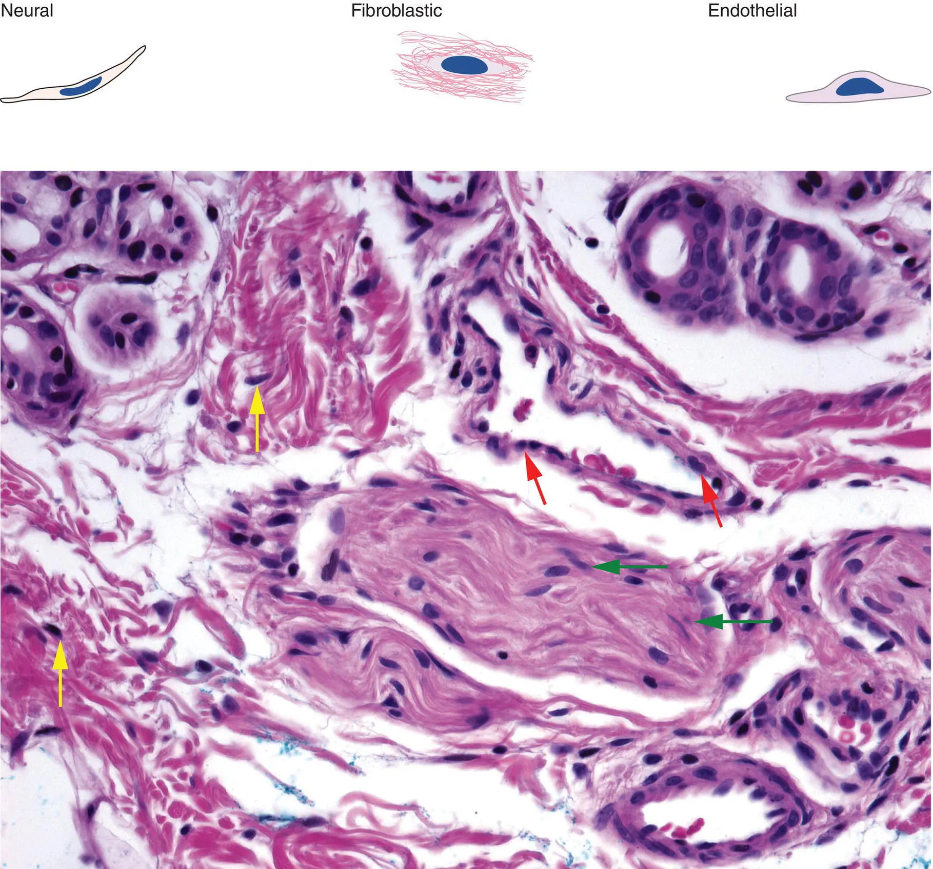 Figure 2CDifferent tumors are predominantly composed of a particular cell - фото 9