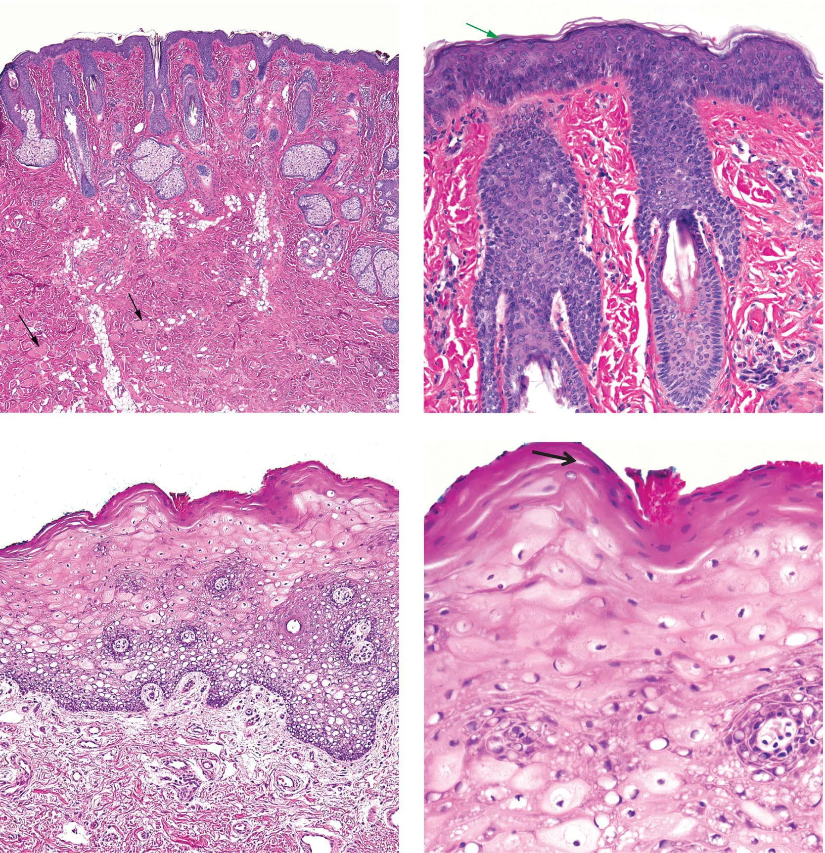 Figure 4BCutaneous lip top row has keratin and a granular layer green - фото 16