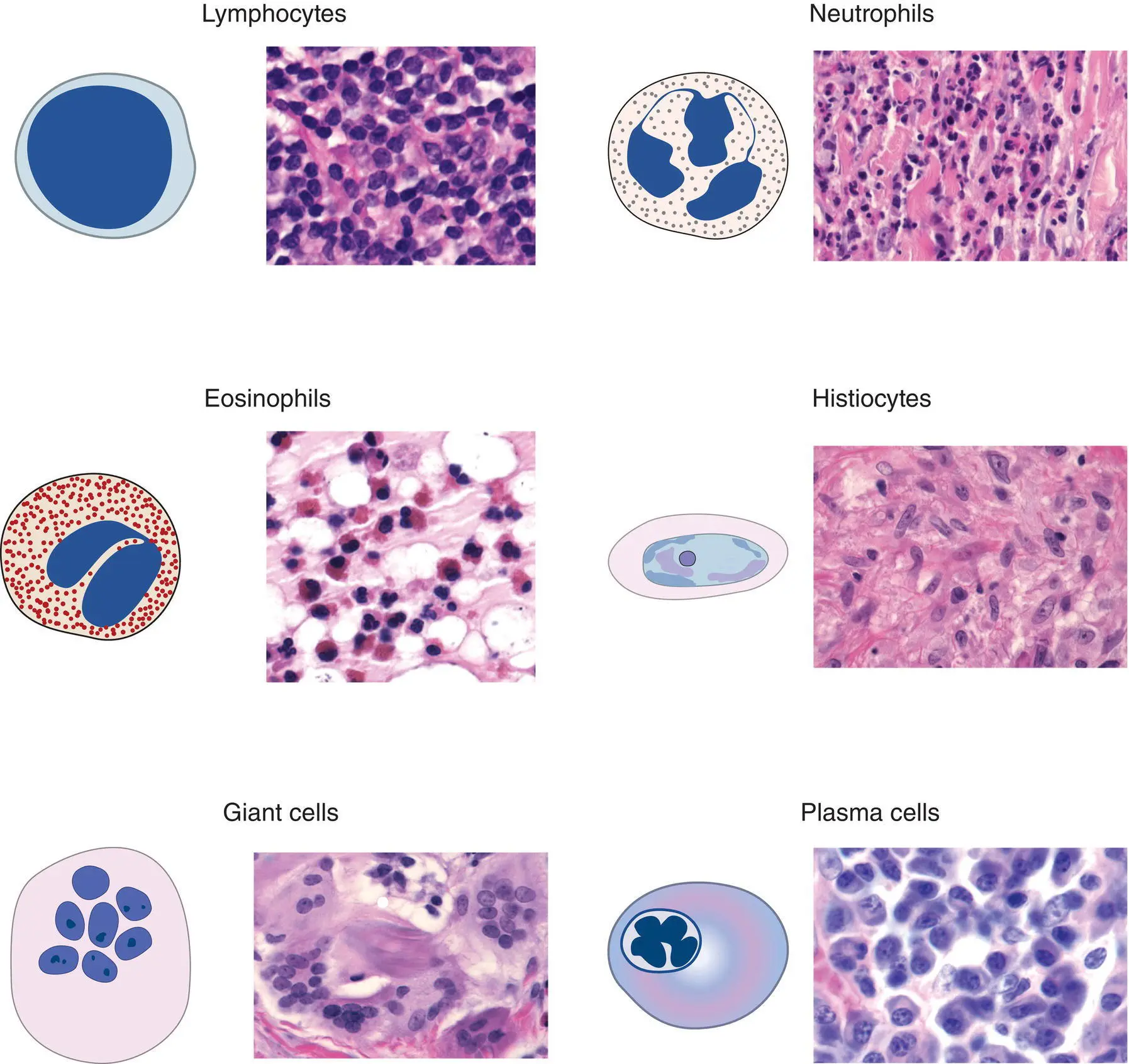 Figure 3CThe morphology of key inflammatory cells Lymphocyte round blue - фото 14