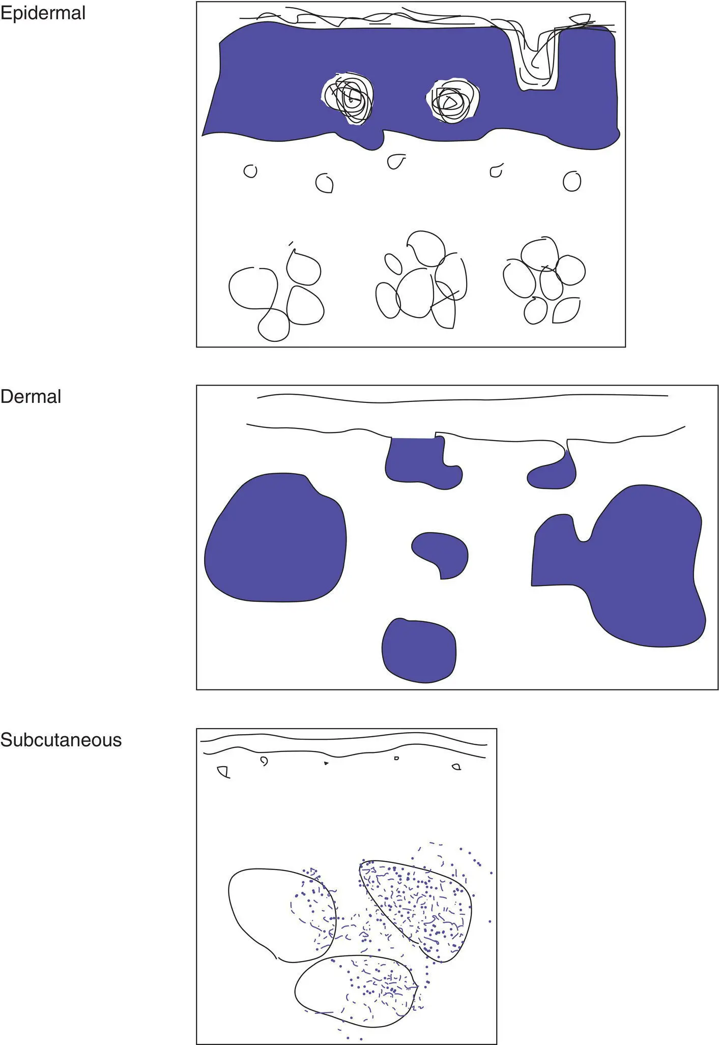 Figure 2ALocation of the tumor Important characteristics to consider for a - фото 4