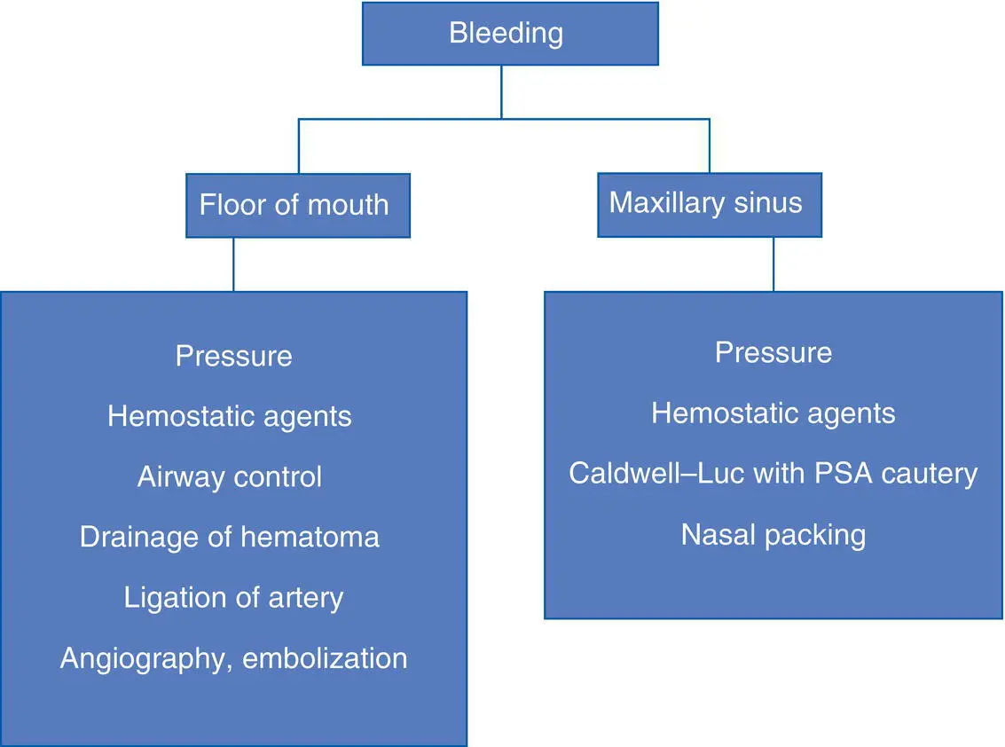 Brisk and pulsatile arterial bleeding can also occur during a maxillary sinus - фото 39
