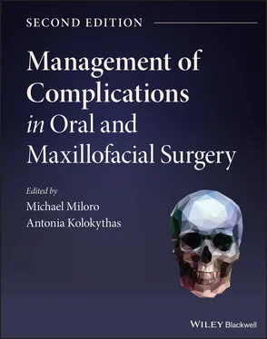 Неизвестный Автор Management of Complications in Oral and Maxillofacial Surgery обложка книги