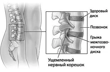 Рис 26 Строение позвоночника Такими малыми зонами левитации в позвоночнике - фото 32