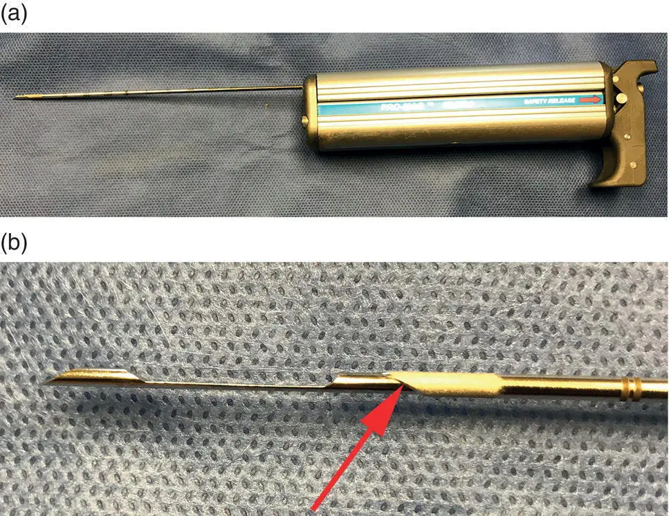 Figure 13 a Automated needle core biopsy instrument b The tip of the - фото 5