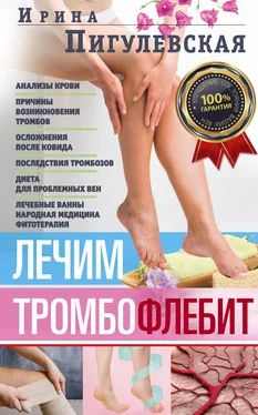 Ирина Пигулевская Лечим тромбофлебит. 100% гарантия улучшения состояния ваших вен обложка книги