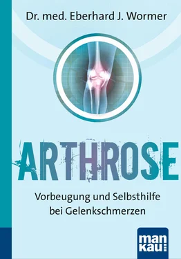 Dr. med. Eberhard J. Wormer Arthrose. Kompakt-Ratgeber обложка книги