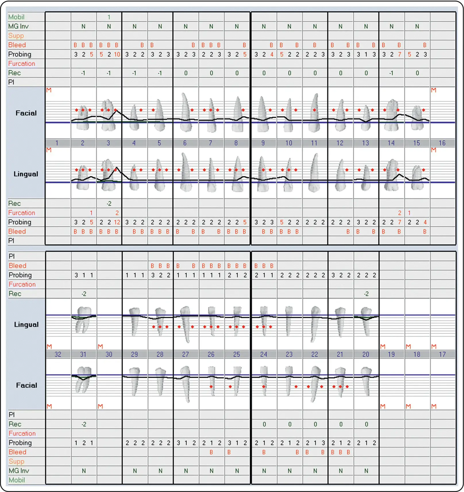 Figure 112Complete periodontal charting Radiographic Examination A - фото 6