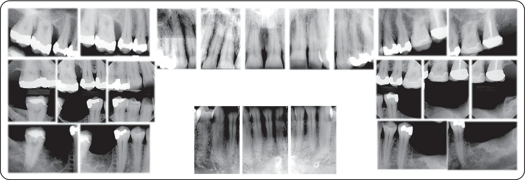 Figure 113Complete series of intraoral radiographs SelfStudy Questions 1 - фото 7