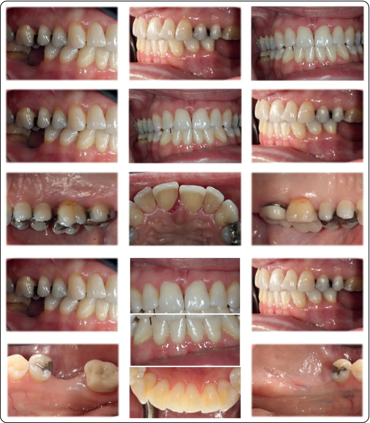 Figure 111Complete series of intraoral photographs Figure 112Complete - фото 5