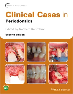 Неизвестный Автор Clinical Cases in Periodontics обложка книги