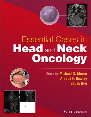 Неизвестный Автор Essential Cases in Head and Neck Oncology обложка книги