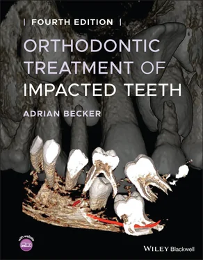 Adrian Becker Orthodontic Treatment of Impacted Teeth обложка книги