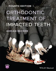 Adrian Becker - Orthodontic Treatment of Impacted Teeth