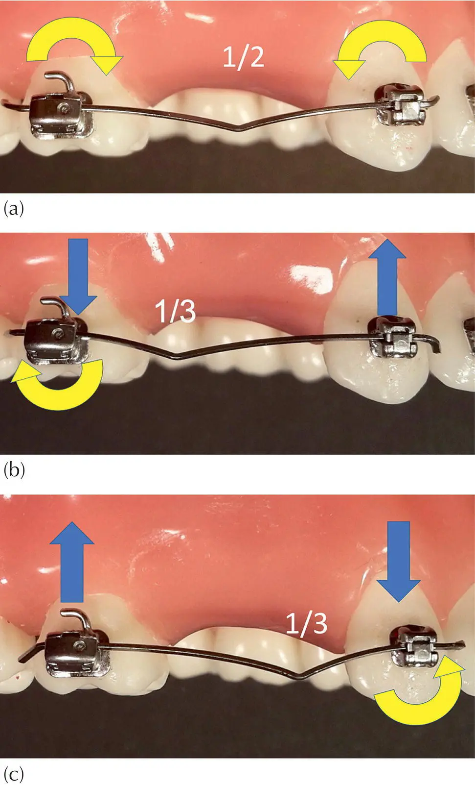 Fig 310 ac Changing the position of the V bend will create totally - фото 31