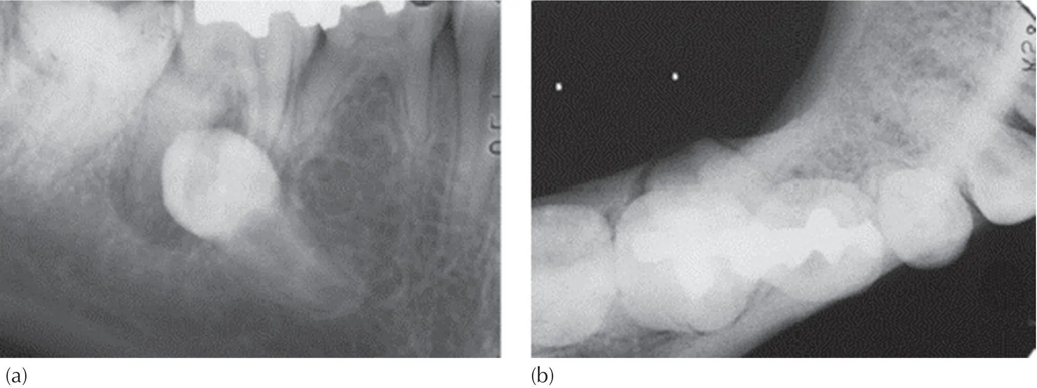 Fig 411 The true lateral and true occlusal views taken together provide all - фото 49