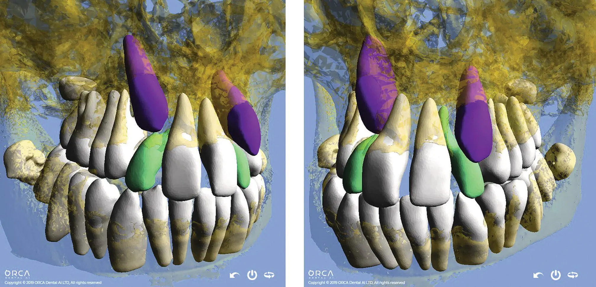 Fig 415 Automatic segmentation artificial intelligence AI driven The - фото 53