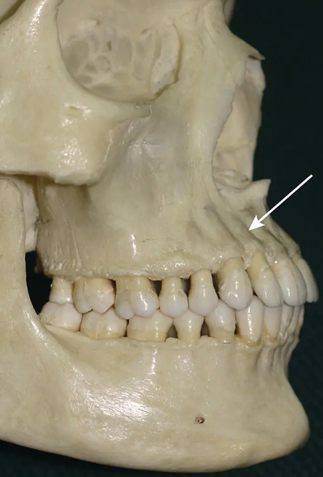 Fig 49 On the dry skull the roots of the maxillary incisor teeth can be seen - фото 47
