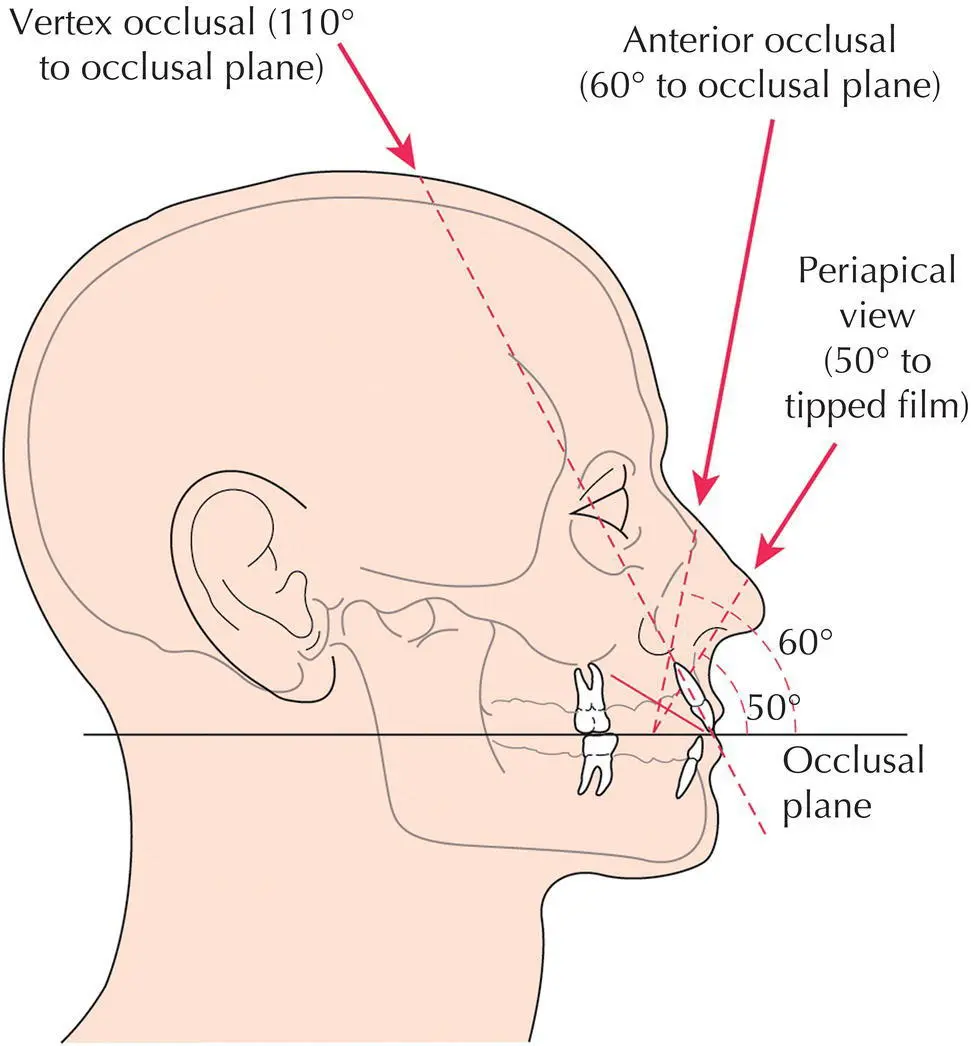 Fig 42 A diagram showing incisor inclination receptor position and central - фото 40