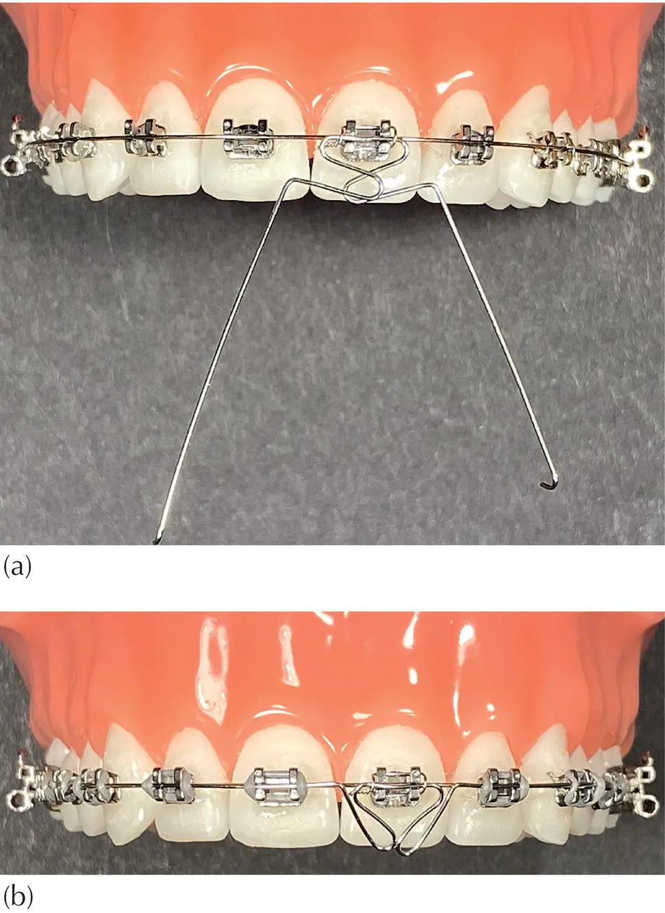 Fig 312 a b A 0016 in main arch is combined with a 0016 in von der - фото 33