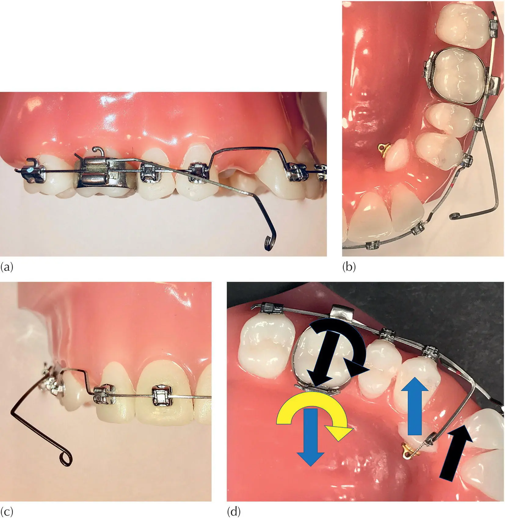 Fig 32 a The passive cantilever made of rectangular wire extends from the - фото 23