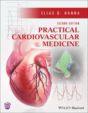 Elias B. Hanna Practical Cardiovascular Medicine обложка книги