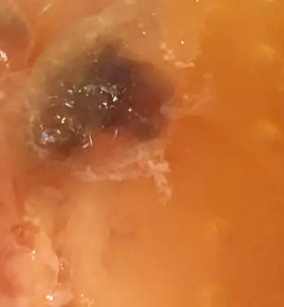 Una masa de levaduras atrapada bajo un nuevo SCOBY puede parecer moho pero es - фото 24