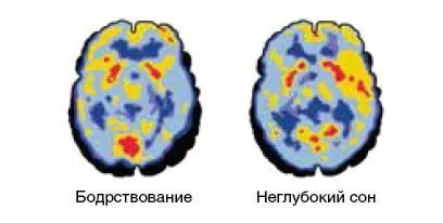 Рис 5 Активность мозга человека находящегося в разных состояниях сна и - фото 7