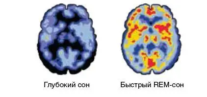 Рис 5 Активность мозга человека находящегося в разных состояниях сна и - фото 8