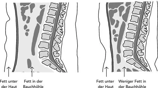 Abbildung 26 Schaut man sich den Körper von der Seite an zeigen diese - фото 15