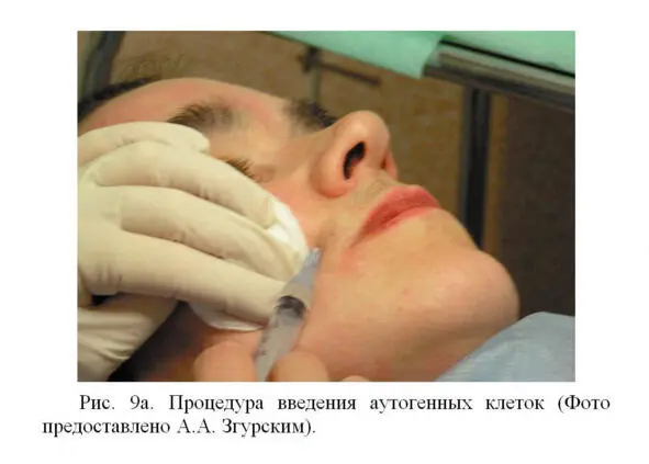 Поверхность кожи в которую вводятся клетки обрабатывается стерилизующими - фото 11