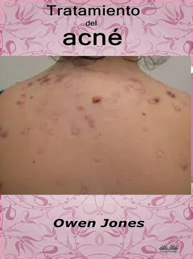 Owen Jones Tratamiento Del Acné обложка книги
