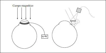Fig 411 Métodos de campo magnético izquierda y de cápsulas de succión - фото 78