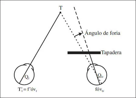 Fig 510 Exoforia en el ojo derecho mostrando la divergencia o abducción - фото 110