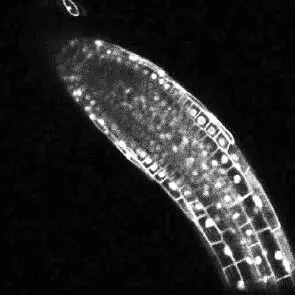 Raíz de Arabidopsis thaliana transformada con una fusión de GFP y una proteína - фото 6