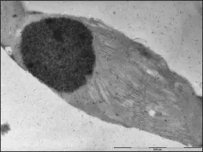 Cloroplasto de tabaco transgénico Imagen de microscopía electrónica de - фото 14