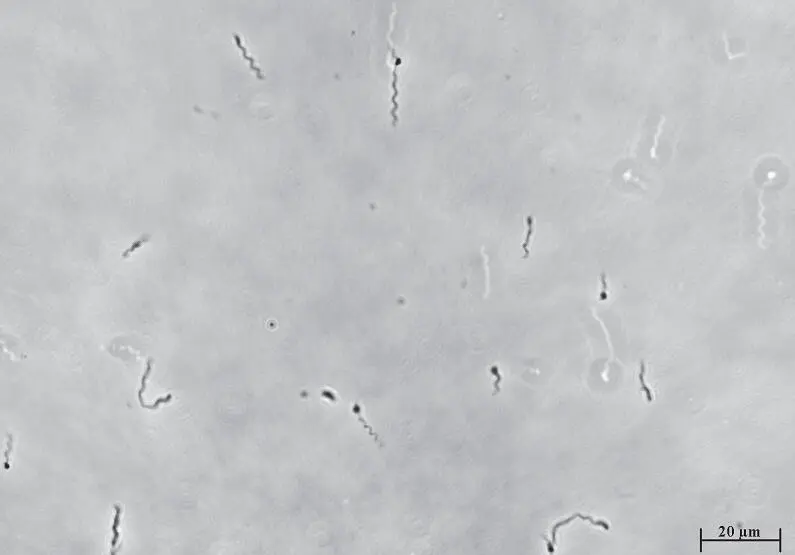 Borrelienspirochäten können sich durch jedes Körpergewebe schrauben Foto M - фото 10